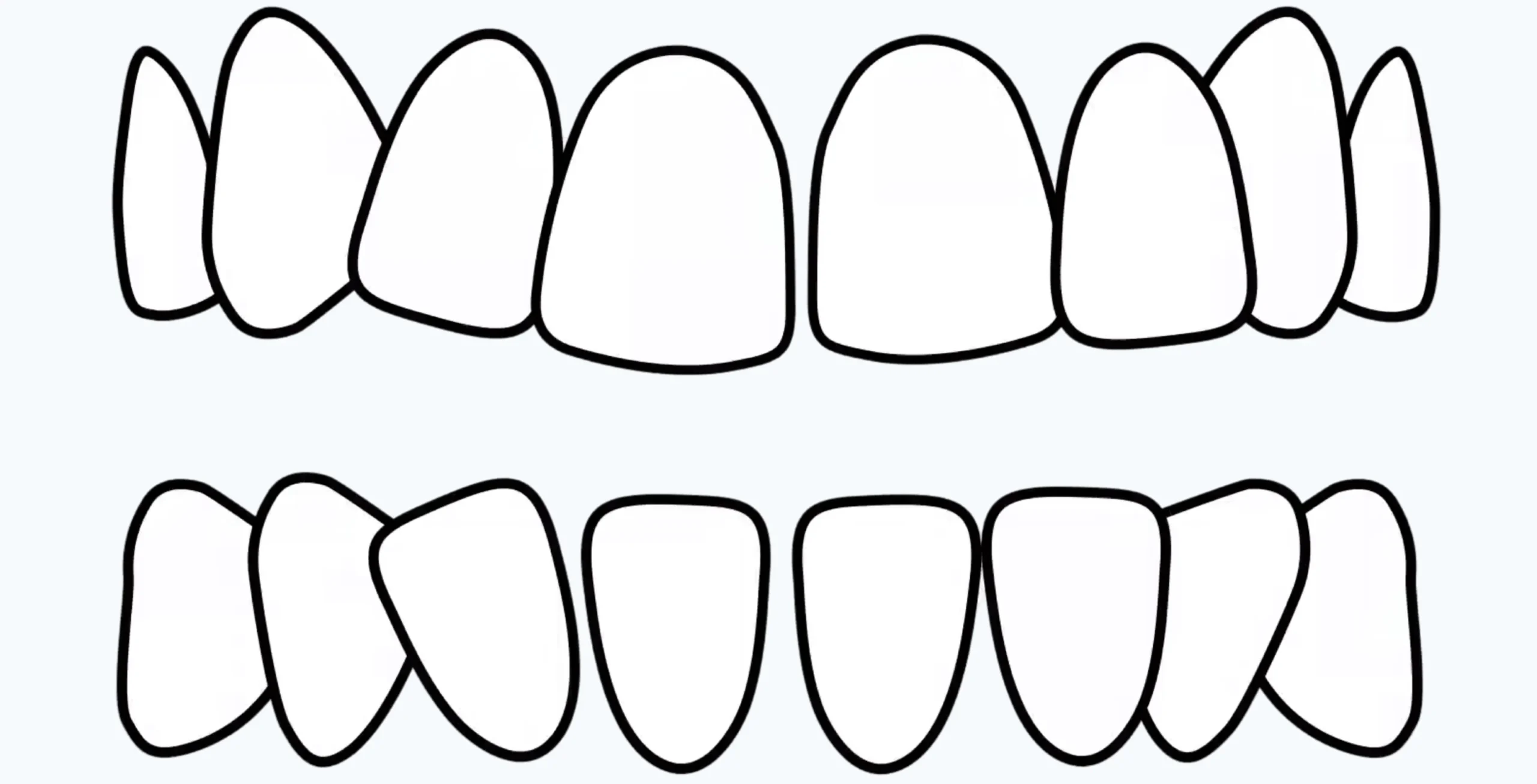 Teeth Diagram